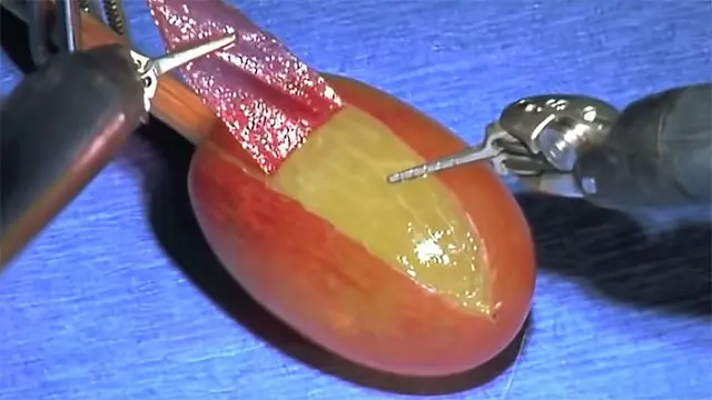 They Did Surgery On a Grape blank meme template