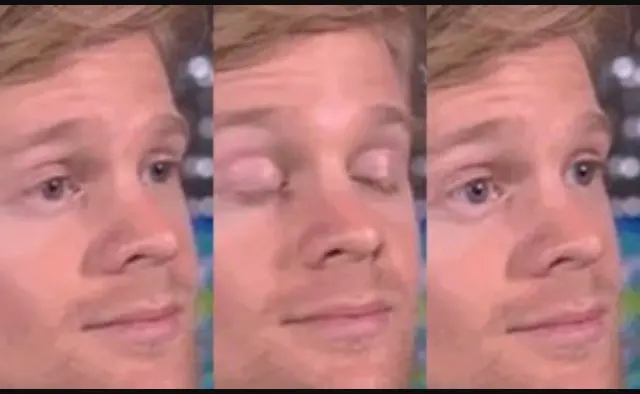 Blinking guy blank meme template
